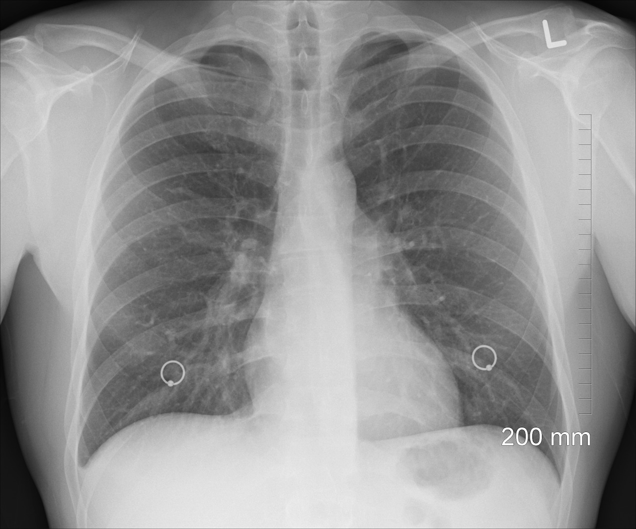 Spirometria